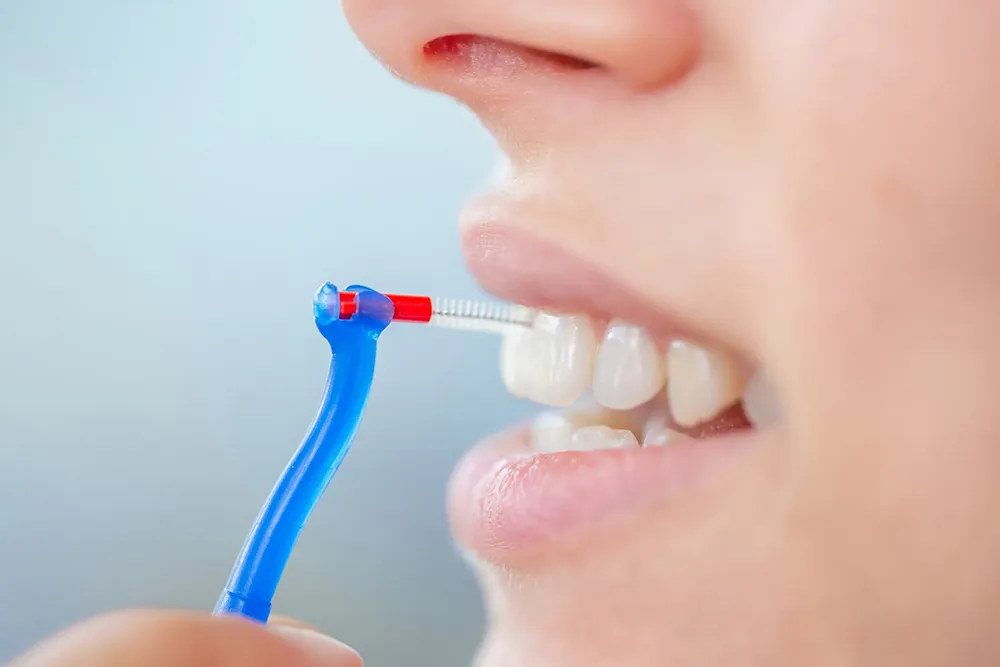 Der richtige Umgang mit einer Interdentalbürste